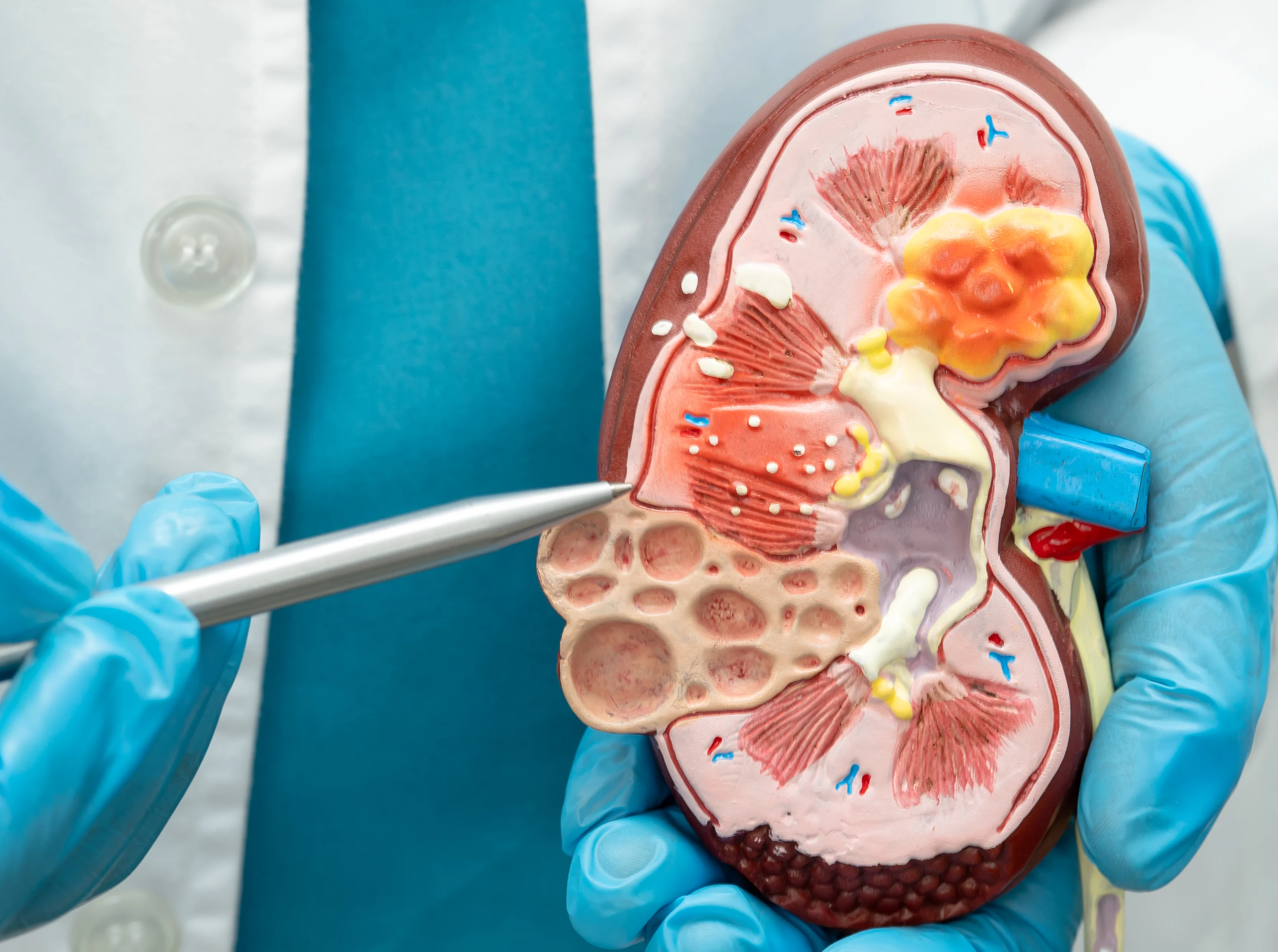 Urology